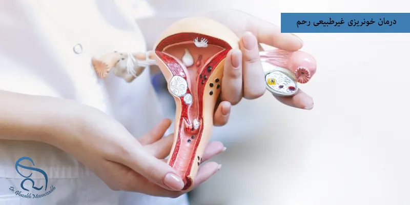 درمان خونریزی غیرطبیعی رحم