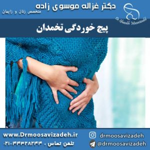 پیچ خوردگی تخمدان