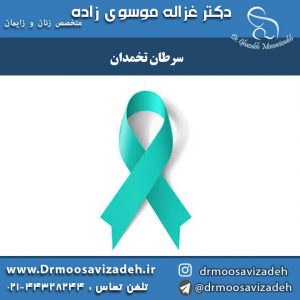 سرطان تخمدان