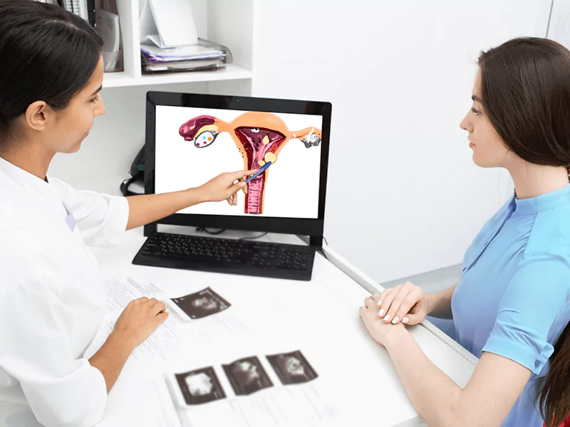 درمان فیبروم یا میوم