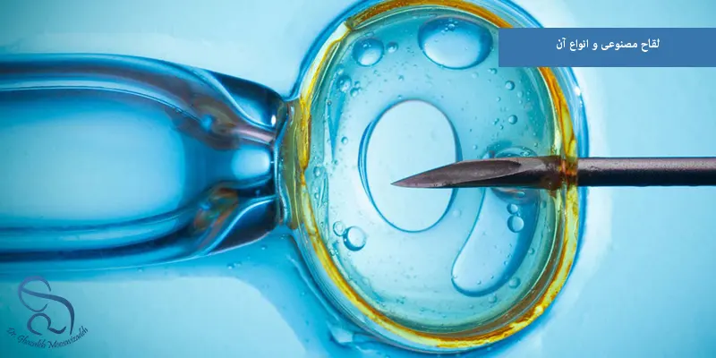 لقاح مصنوعی و انواع آن