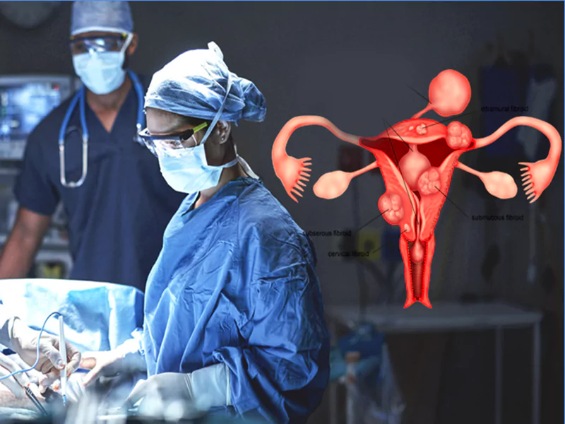 جراحی فیبروم رحم چیست؟