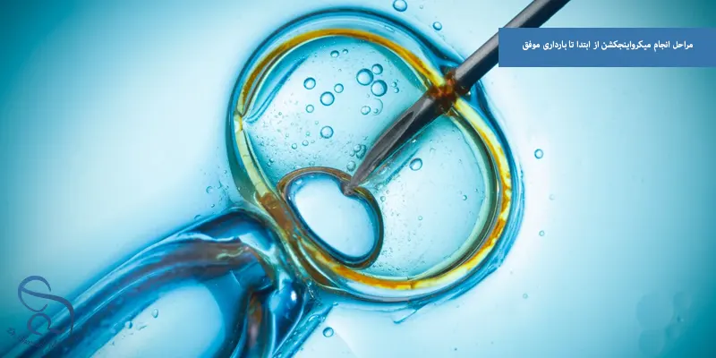 مراحل انجام میکرواینجکشن از ابتدا تا بارداری موفق