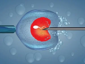 میکرواینجکشن چیست