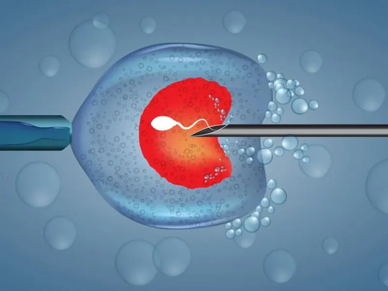 میکرواینجکشن چیست