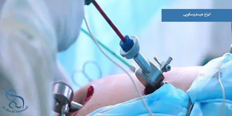 انواع هیستروسکوپی
