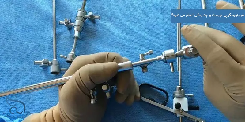 هیستروسکوپی چیست و چه زمانی انجام می شود؟