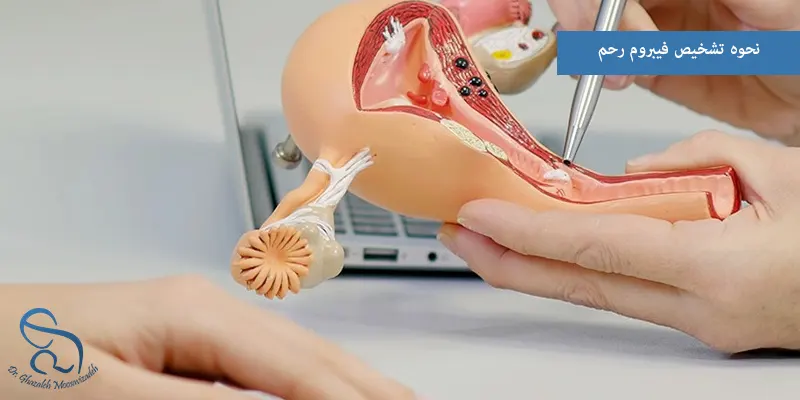 نحوه تشخیص فیبروم رحم
