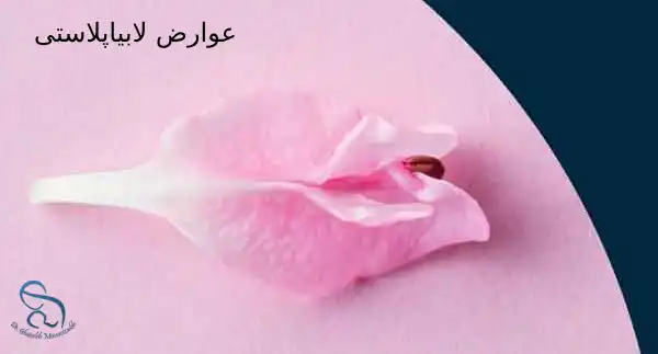 عوارض لابیاپلاستی