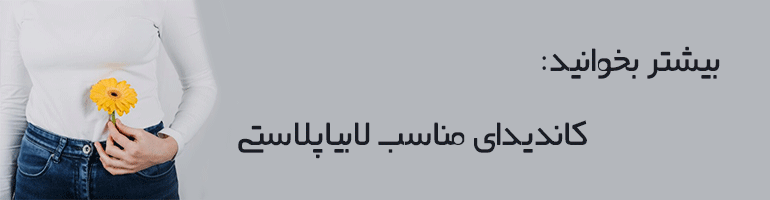 هزینه عمل لابیاپلاستی هزینه عمل لابیاپلاستی