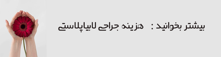 عمل لابیاپلاستی