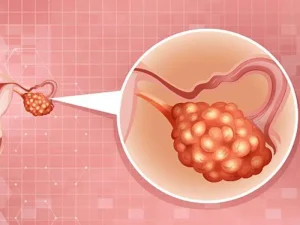 افزایش کیفیت تخمک