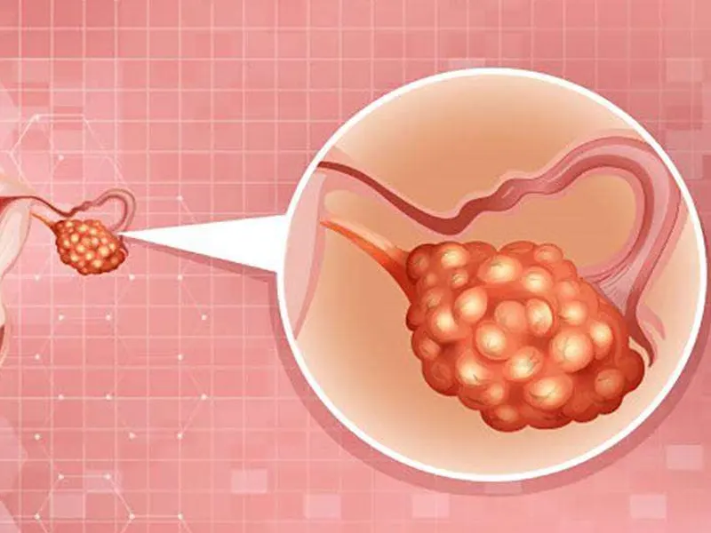 افزایش کیفیت تخمک