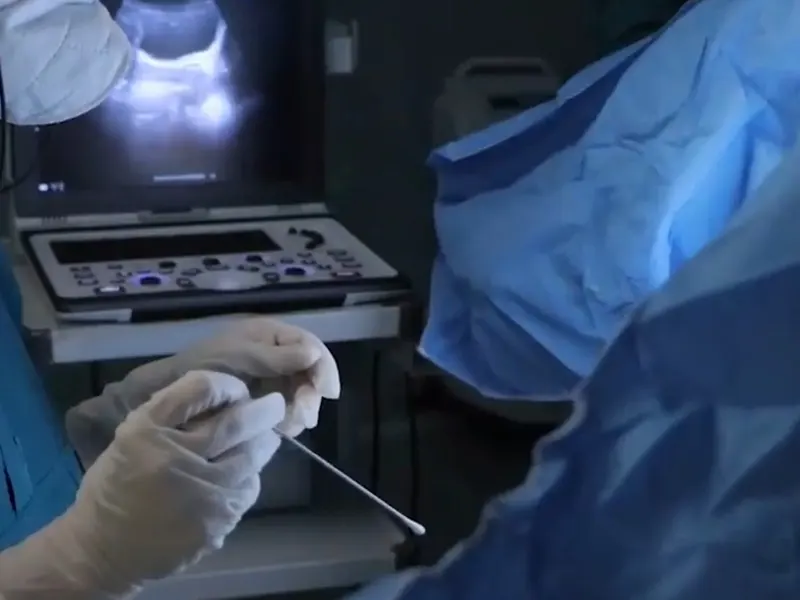 انتقال جنین به چه صورت است